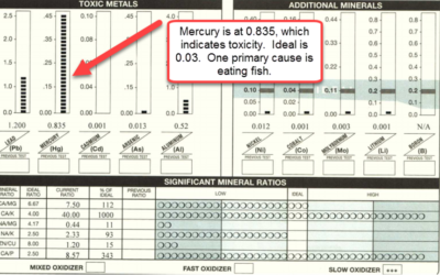 Mercury and Detox