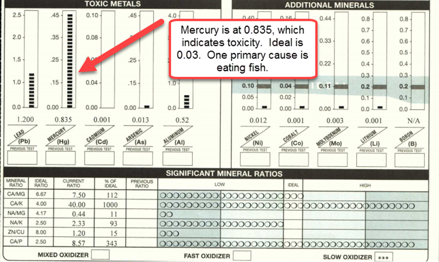 Mercury and Detox