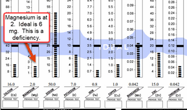 Magnesium Deficiency Test