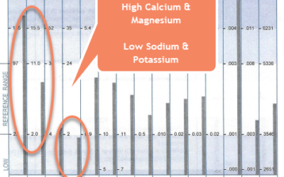 Memory Loss, Headaches, and Fatigue:  Hair Analysis of a 45 year Old Woman