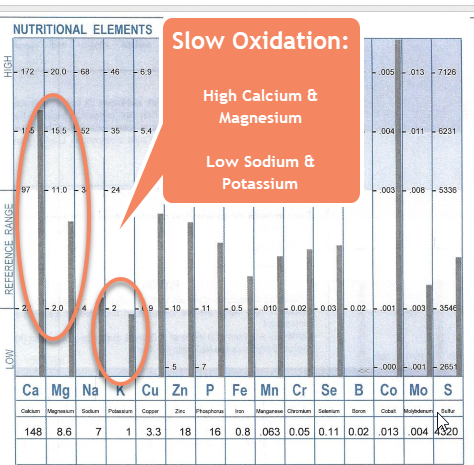 Memory Loss, Headaches, and Fatigue:  Hair Analysis of a 45 year Old Woman