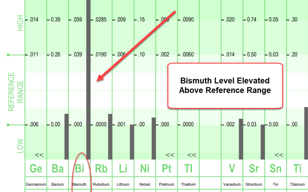 Elevated Bismuth on a Hair Analysis Test:  Source of Exposure?  Burn Ointments.